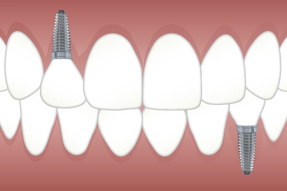 Какие услуги предлагают современные стоматологические клиники?